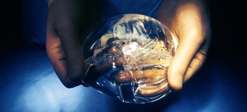 Endoprotesi in silicone