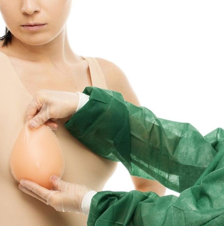 Protesi per l'allargamento del seno